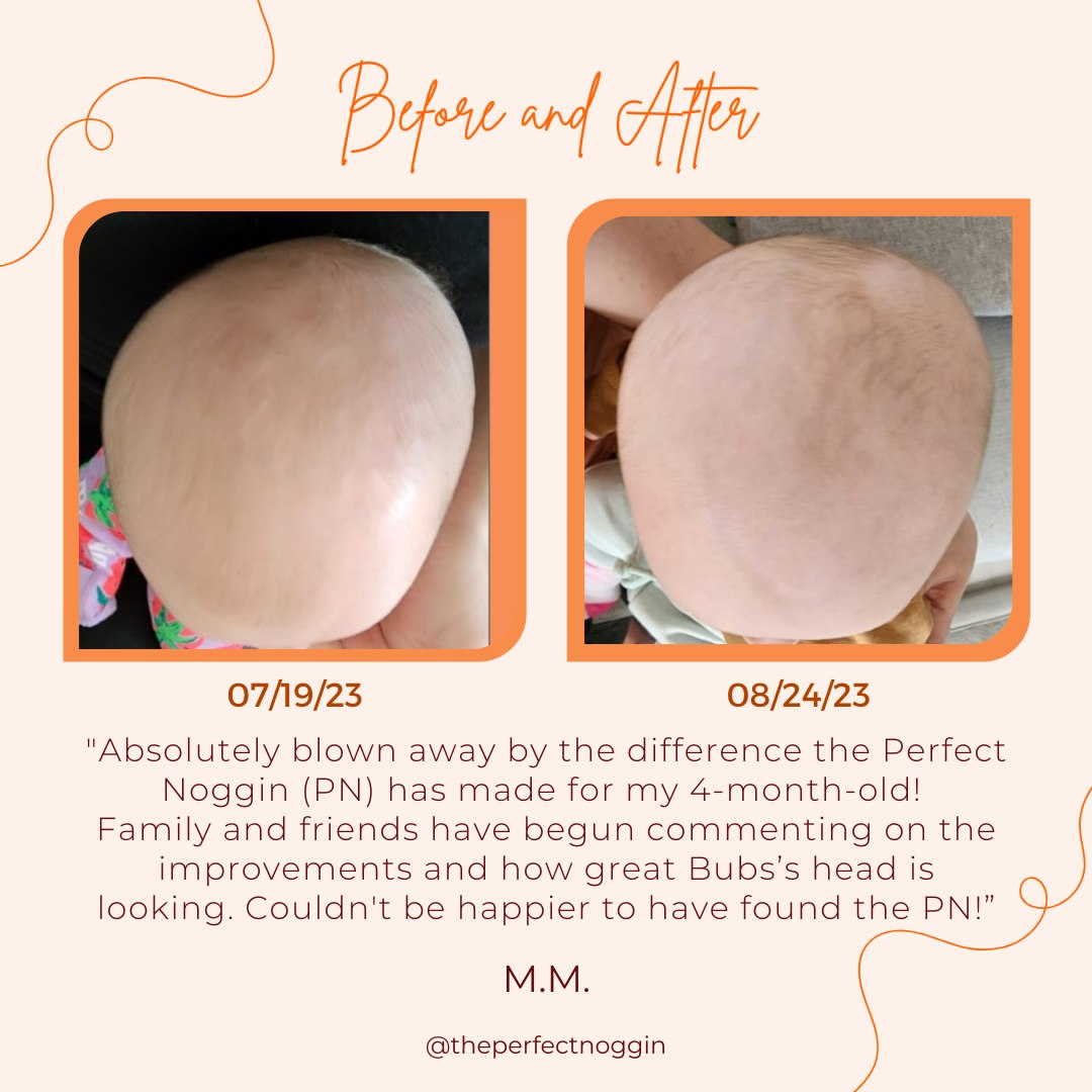 Perfect Noggin 2.0Plus Blemished model - Head Shaping Mattress
