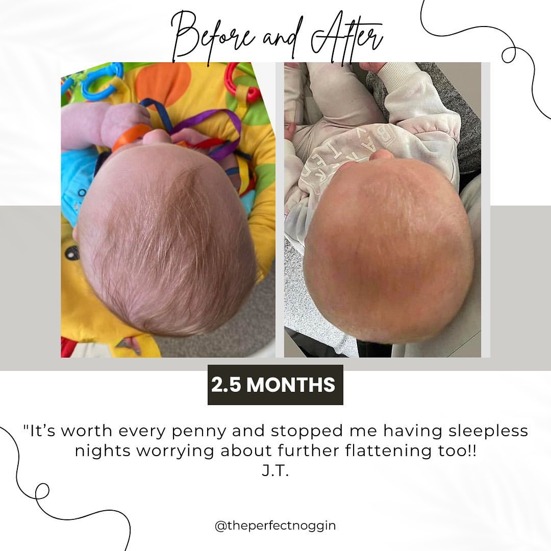 Perfect Noggin 2.0Plus Blemished model - Head Shaping Mattress