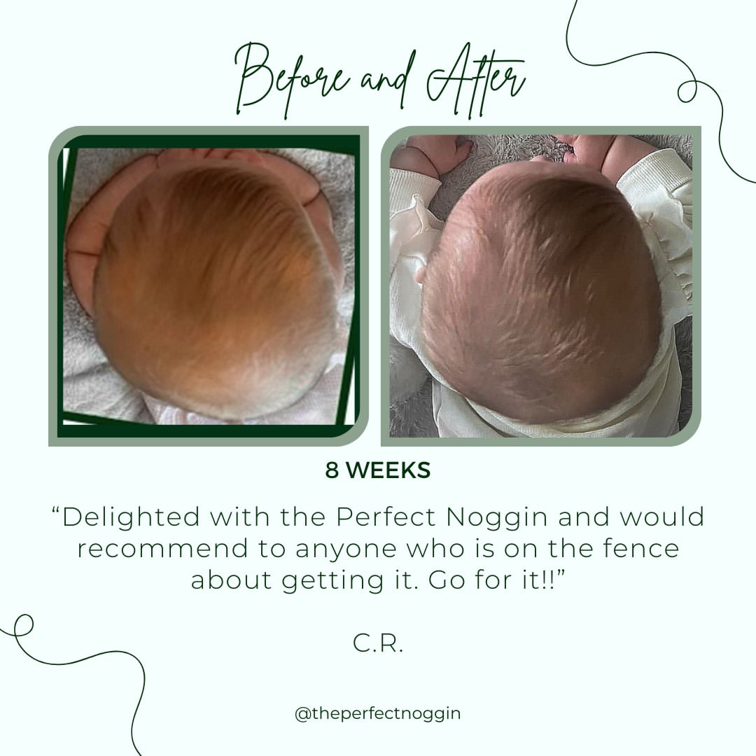 Perfect Noggin 2.0Plus Blemished model - Head Shaping Mattress