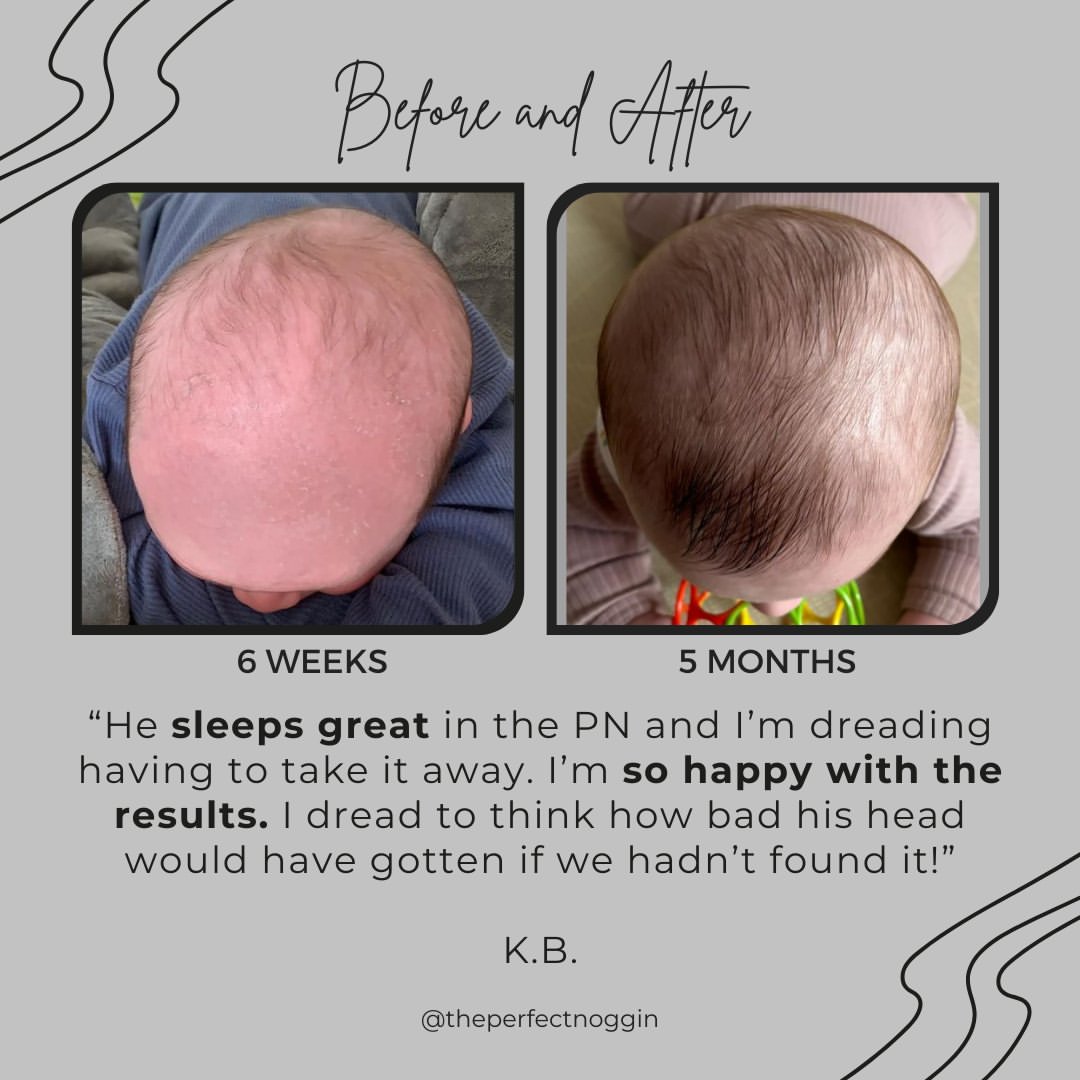 Perfect Noggin 2.0Plus Blemished model - Head Shaping Mattress