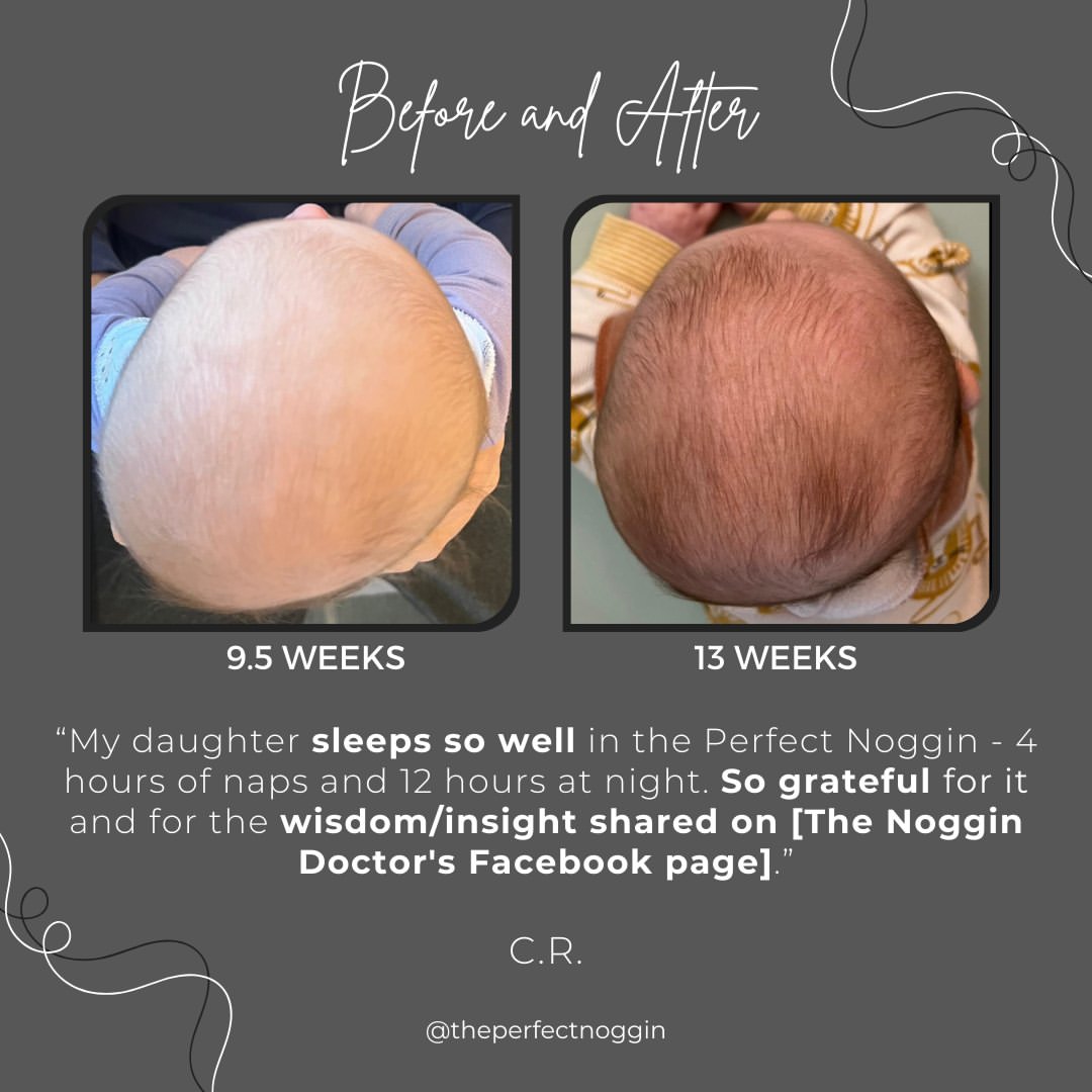 Perfect Noggin 2.0Plus Blemished model - Head Shaping Mattress