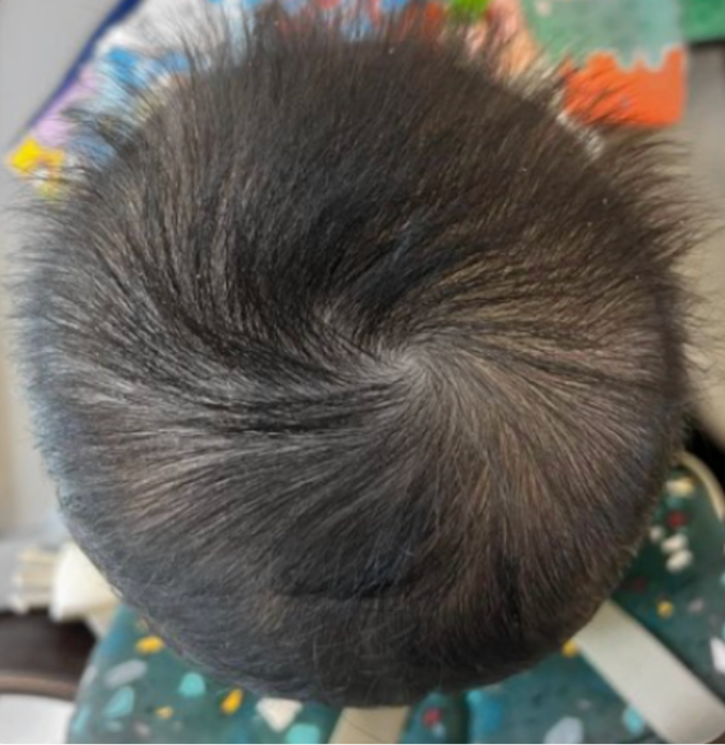 After