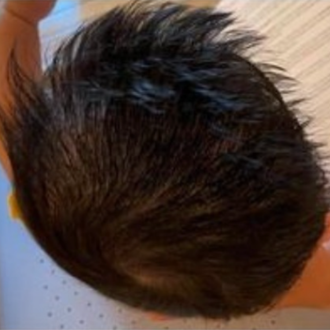 Before