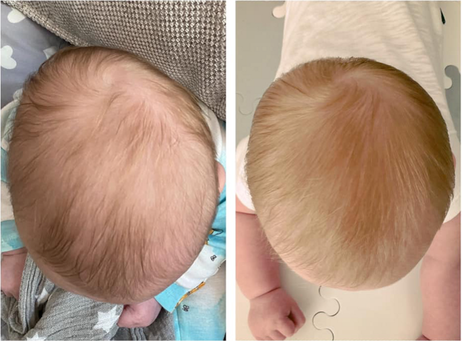 Before and after