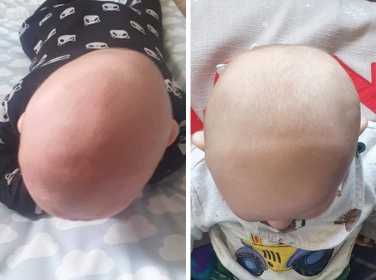 Before and after