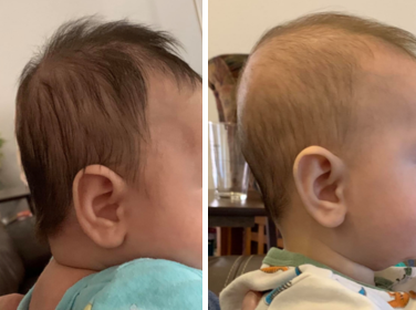Before and after