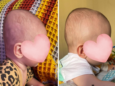 Before and after