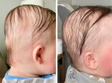 Before and after